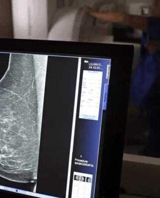 Falta de acesso a mamógrafos limita prevenção do câncer de mama