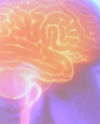 Por que o AVC vem afetando mais jovens de 18 a 45 anos?