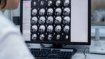 Médico observa exames de imagem do cérebro de um paciente