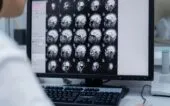 Médico observa exames de imagem do cérebro de um paciente