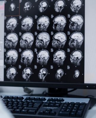 Médico observa exames de imagem do cérebro de um paciente