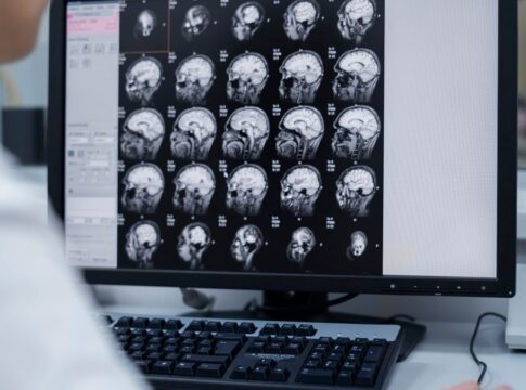 Médico observa exames de imagem do cérebro de um paciente