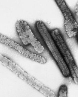 Etiópia confirma 14 casos e 9 mortes por vírus Marburg