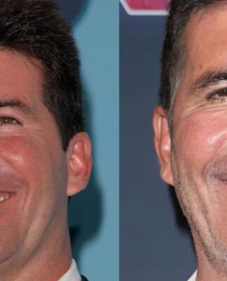 Montagem com duas fotos lado a lado mostrando o rosto de um homem adulto sorrindo; na imagem à esquerda, a pele parece mais lisa e jovem, enquanto na imagem à direita o homem aparenta estar mais velho, com linhas de expressão mais visíveis e dentes mais brancos.