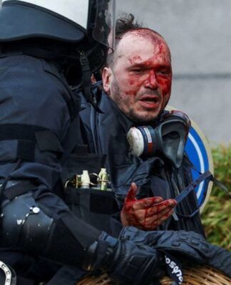 A foto apresenta um plano médio que foca no confronto direto entre um manifestante ferido e um policial da tropa de choque. A cena é dramática e possui um forte impacto visual devido ao contraste entre o sangue e o equipamento policial.