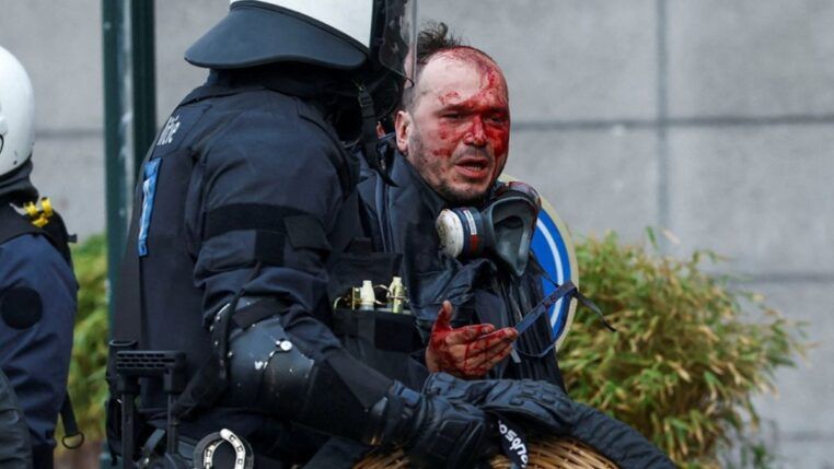 A foto apresenta um plano médio que foca no confronto direto entre um manifestante ferido e um policial da tropa de choque. A cena é dramática e possui um forte impacto visual devido ao contraste entre o sangue e o equipamento policial.