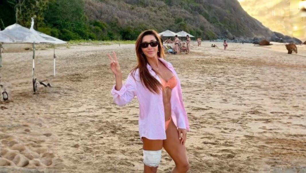 Tayane Dalazen postou foto de seu machucado na perna em uma rede social