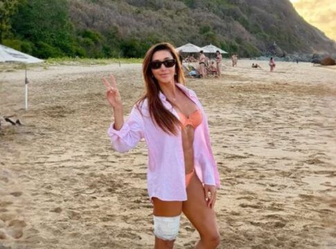 Tayane Dalazen postou foto de seu machucado na perna em uma rede social