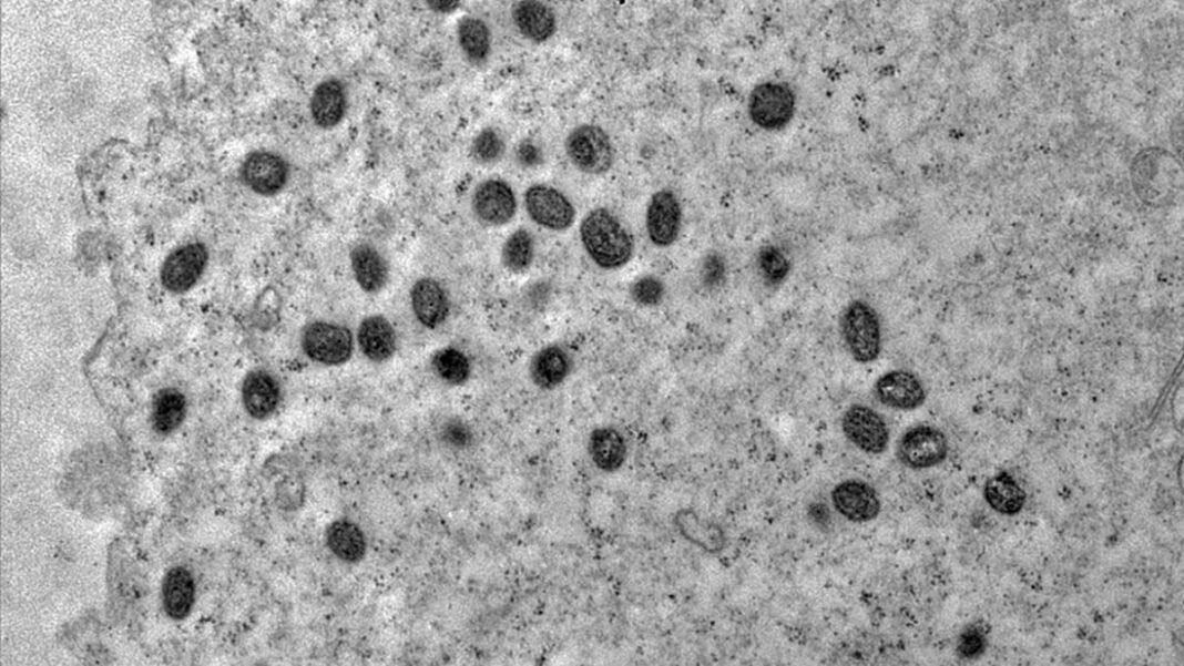 Imagem de microscópio do vírus