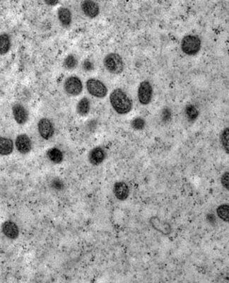 Imagem de microscópio do vírus