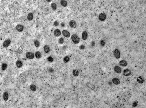 Imagem de microscópio do vírus