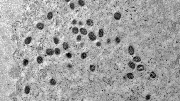 Imagem de microscópio do vírus