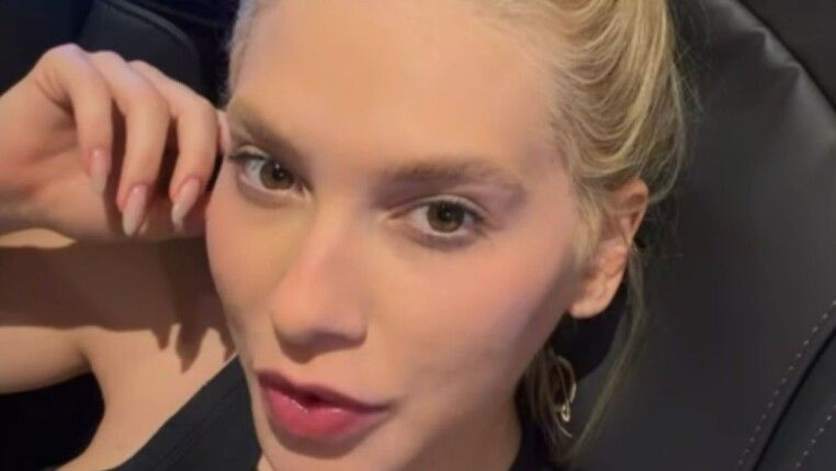 Virginia com o cabelo preso e mão no rosto.