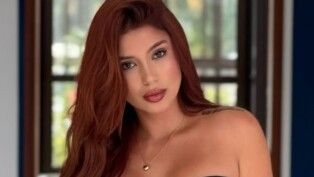 Influenciadora relata sequelas permanentes (Reprodução/Instagram/maari.tavares)