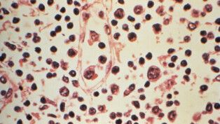 Imagem microscópica do hantavírus