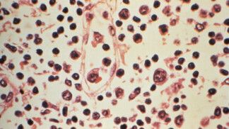 Imagem microscópica do hantavírus