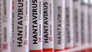 Diversos tubos com a inscrição "hantavírus" em cada um deles