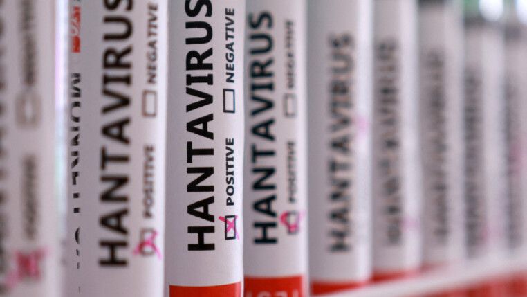 Diversos tubos com a inscrição "hantavírus" em cada um deles