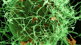 FILE PHOTO: A digitally colorized scanning electron micrograph depiction shows numerous filamentous Ebola virus particles in green, budding from a chronically infected VERO E6 cell in orange at 25,000X magnification in this undated handout picture from the National Institute of Allergy and Infectious Diseases (NIAID). REUTERS/National Institute of Allergy and Infectious Diseases/Handout via Reuters THIS IMAGE HAS BEEN SUPPLIED BY A THIRD PARTY. IT IS DISTRIBUTED, EXACTLY AS RECEIVED BY REUTERS, AS A SERVICE TO CLIENTS. FOR EDITORIAL USE ONLY. NOT FOR SALE FOR MARKETING OR ADVERTISING CAMPAIGNS/File Photo