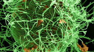 FILE PHOTO: A digitally colorized scanning electron micrograph depiction shows numerous filamentous Ebola virus particles in green, budding from a chronically infected VERO E6 cell in orange at 25,000X magnification in this undated handout picture from the National Institute of Allergy and Infectious Diseases (NIAID). REUTERS/National Institute of Allergy and Infectious Diseases/Handout via Reuters THIS IMAGE HAS BEEN SUPPLIED BY A THIRD PARTY. IT IS DISTRIBUTED, EXACTLY AS RECEIVED BY REUTERS, AS A SERVICE TO CLIENTS. FOR EDITORIAL USE ONLY. NOT FOR SALE FOR MARKETING OR ADVERTISING CAMPAIGNS/File Photo